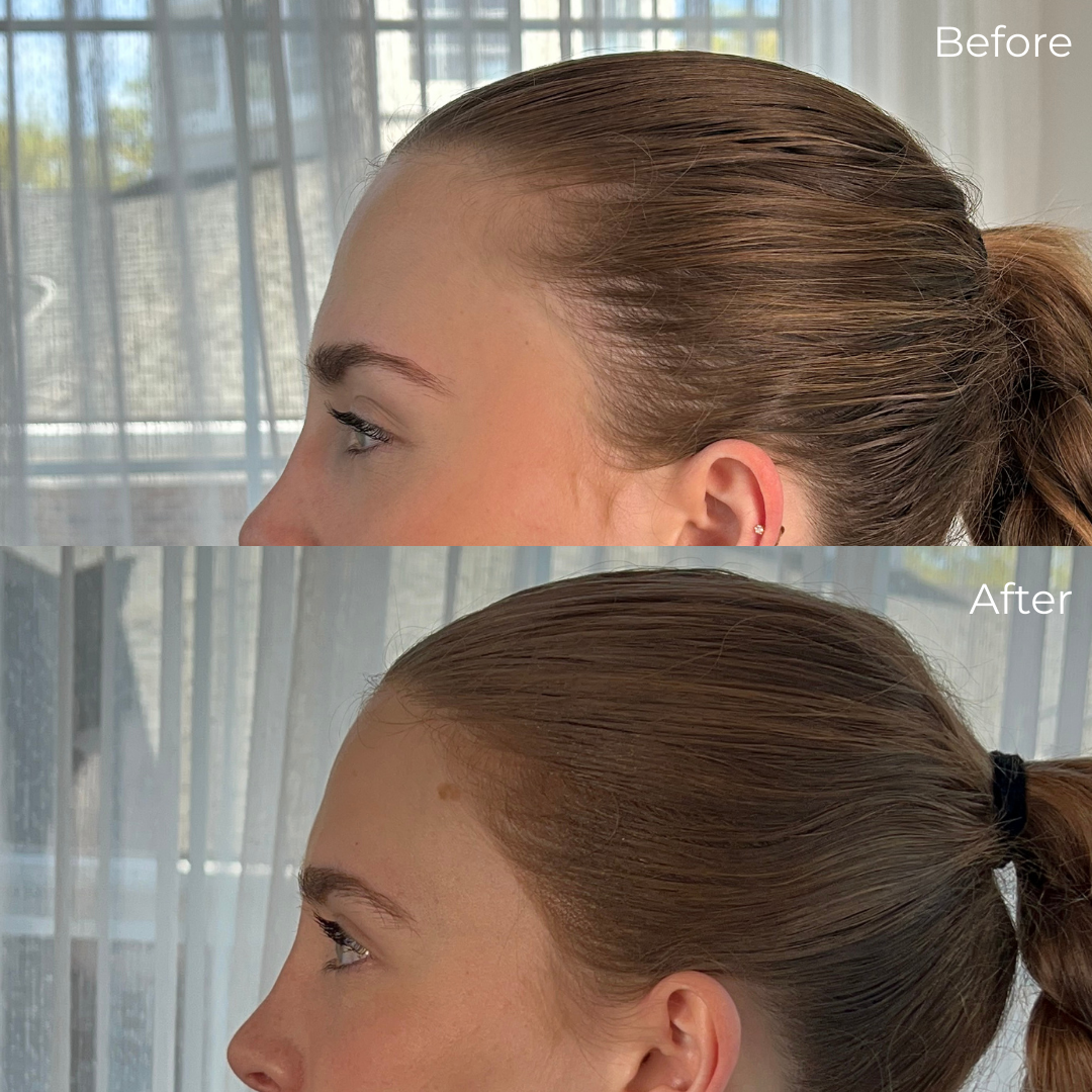 ICOSIUM - Hairline Powder