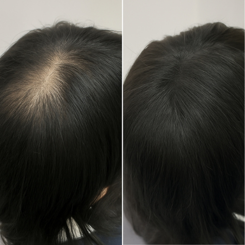 ICOSIUM - Hairline Powder